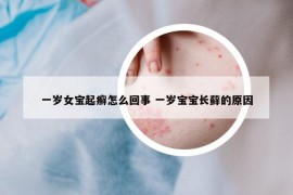 一歲女寶起癬怎么回事 一歲寶寶長(zhǎng)蘚的原因