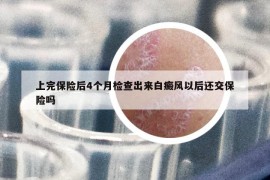 上完保險后4個月檢查出來白癜風(fēng)以后還交保險嗎