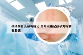 孩子為什么會有胎記 父母沒胎記孩子為啥會有胎記