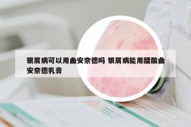 銀屑病可以用曲安奈德嗎 銀屑病能用醋酸曲安奈德乳膏