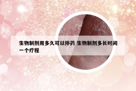生物制劑用多久可以停藥 生物制劑多長(zhǎng)時(shí)間一個(gè)療程