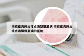 南京皮炎所治療點(diǎn)滴型銀屑病 南京皮炎所治療點(diǎn)滴型銀屑病的醫(yī)院