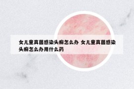 女兒童真菌感染頭癬怎么辦 女兒童真菌感染頭癬怎么辦用什么藥