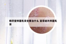 穆藥堂抑菌乳膏主要治什么 苗家秘方抑菌乳膏