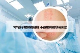 9歲孩子銀屑病初期 小孩銀屑病容易自愈