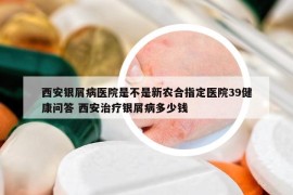 西安銀屑病醫(yī)院是不是新農(nóng)合指定醫(yī)院39健康問答 西安治療銀屑病多少錢