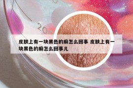 皮膚上有一塊黑色的癬怎么回事 皮膚上有一塊黑色的癬怎么回事兒