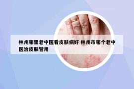 林州哪里老中醫(yī)看皮膚病好 林州市哪個老中醫(yī)治皮膚管用