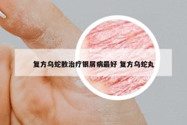復(fù)方烏蛇散治療銀屑病最好 復(fù)方烏蛇丸