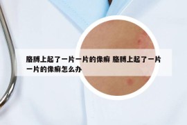 胳膊上起了一片一片的像癬 胳膊上起了一片一片的像癬怎么辦