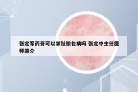 張定軍藥膏可以掌趾膿包病嗎 張定中主任醫(yī)師簡介