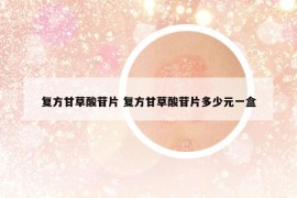 復(fù)方甘草酸苷片 復(fù)方甘草酸苷片多少元一盒