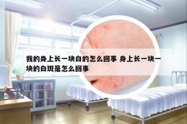 我的身上長一塊白的怎么回事 身上長一塊一塊的白斑是怎么回事
