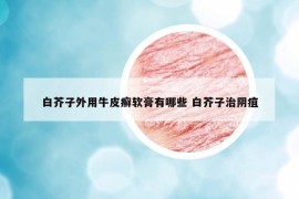 白芥子外用牛皮癬軟膏有哪些 白芥子治陰疽