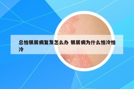 總怕銀屑病復(fù)發(fā)怎么辦 銀屑病為什么怕冷怕冷