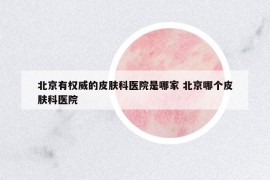 北京有權威的皮膚科醫(yī)院是哪家 北京哪個皮膚科醫(yī)院