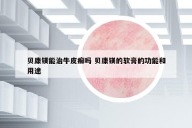 貝康鎂能治牛皮癬嗎 貝康鎂的軟膏的功能和用途