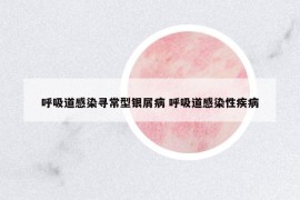 呼吸道感染尋常型銀屑病 呼吸道感染性疾病