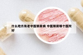 什么地方有老中醫(yī)銀屑病 中醫(yī)銀屑哪個(gè)醫(yī)院好