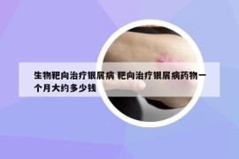生物靶向治療銀屑病 靶向治療銀屑病藥物一個(gè)月大約多少錢