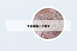 牛皮癬猜一個數字