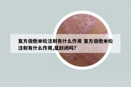 復(fù)方倍他米松注射有什么作用 復(fù)方倍他米松注射有什么作用,是封閉嗎?