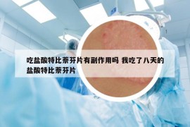 吃鹽酸特比萘芬片有副作用嗎 我吃了八天的鹽酸特比萘芬片