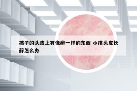 孩子的頭皮上有像癬一樣的東西 小孩頭皮長蘚怎么辦