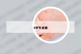 9歲牛皮癬