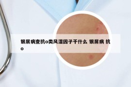 銀屑病查抗o類風濕因子干什么 銀屑病 抗o