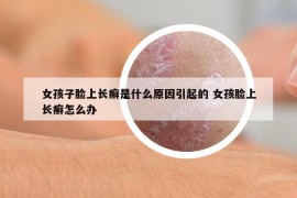 女孩子臉上長癬是什么原因引起的 女孩臉上長癬怎么辦