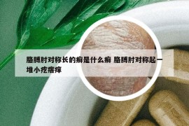 胳膊肘對稱長的癬是什么癬 胳膊肘對稱起一堆小疙瘩癢