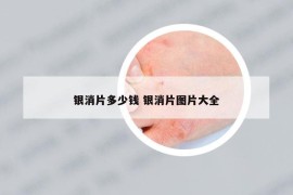銀消片多少錢 銀消片圖片大全
