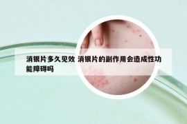 消銀片多久見(jiàn)效 消銀片的副作用會(huì)造成性功能障礙嗎
