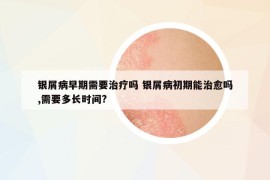 銀屑病早期需要治療嗎 銀屑病初期能治愈嗎,需要多長時間?