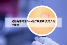 光動力學(xué)療法5ala治療銀屑病 光動力治療指南