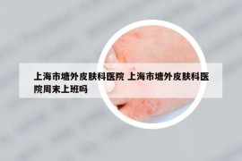 上海市塘外皮膚科醫(yī)院 上海市塘外皮膚科醫(yī)院周末上班嗎
