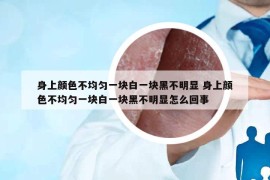 身上顏色不均勻一塊白一塊黑不明顯 身上顏色不均勻一塊白一塊黑不明顯怎么回事