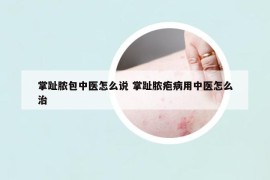 掌趾膿包中醫(yī)怎么說(shuō) 掌趾膿皰病用中醫(yī)怎么治
