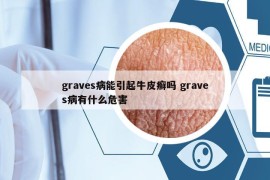 graves病能引起牛皮癬嗎 graves病有什么危害