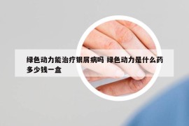 綠色動力能治療銀屑病嗎 綠色動力是什么藥多少錢一盒