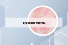兒童白癜風(fēng)發(fā)病快嗎