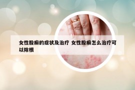 女性股癬的癥狀及治療 女性股癬怎么治療可以除根