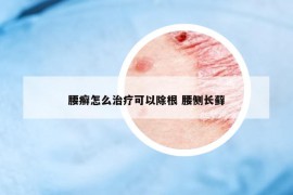 腰癬怎么治療可以除根 腰側(cè)長(zhǎng)蘚