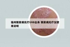 福州銀屑病光療UVB全身 銀屑病光療儀使用說(shuō)明