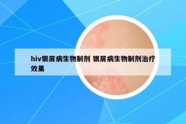 hiv銀屑病生物制劑 銀屑病生物制劑治療效果