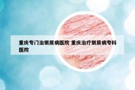 重慶專門治銀屑病醫(yī)院 重慶治療銀屑病?？漆t(yī)院