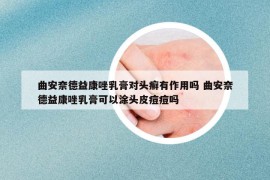 曲安奈德益康唑乳膏對(duì)頭癬有作用嗎 曲安奈德益康唑乳膏可以涂頭皮痘痘嗎