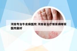 河南專治牛皮癬醫(yī)院 河南省治療銀屑病哪家醫(yī)院最好