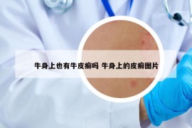 牛身上也有牛皮癬嗎 牛身上的皮癬圖片